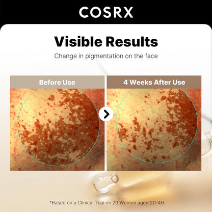 COSRX 2% Alpha Arbutin Discoloration Care Face Serum | 1.7 fl oz